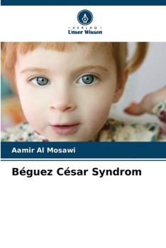 Paperback Béguez César Syndrom [German] Book
