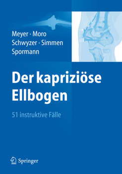 Hardcover Der Kapriziöse Ellbogen: 51 Instruktive Fälle [German] Book