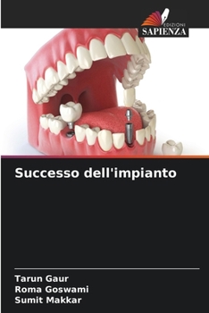 Paperback Successo dell'impianto [Italian] Book