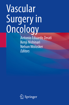 Paperback Vascular Surgery in Oncology Book