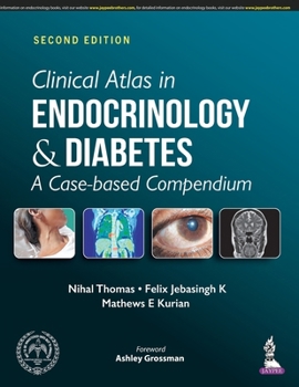 Paperback Clinical Atlas in Endocrinology and Diabetes Book