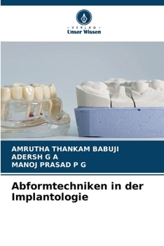 Abformtechniken in der Implantologie (German Edition)