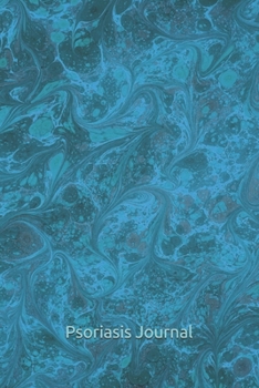 Psoriasis Journal: Living With Psoriasis Symptoms, Treatments, Personal Health Care Diary, Skin Disease Management Notebook, Blue Abstract Art Pattern Journal