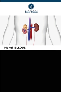 Paperback Lupusnephropathie bei Kindern [German] Book