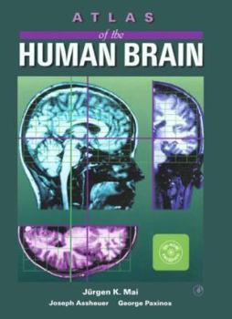 Hardcover Atlas of the Human Brain (Deluxe Edition) [With 3-D Computerized Reditions of a Variety of Brain S] Book