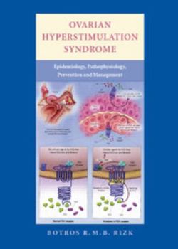 Hardcover Ovarian Hyperstimulation Syndrome: Epidemiology, Pathophysiology, Prevention and Management Book