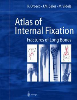 Paperback Atlas of Internal Fixation : Fractures of Long Bones: Classification, Statistical Analysis, Technique, Radiology Book