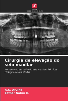 Paperback Cirurgia de elevação do seio maxilar [Portuguese] Book