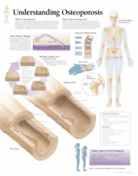 Misc. Understanding Osteoporosis Chart: Laminated Wall Chart Book