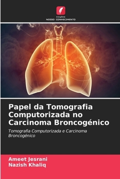 Paperback Papel da Tomografia Computorizada no Carcinoma Broncogénico [Portuguese] Book