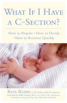 Paperback What If I Have a C-Section? Book