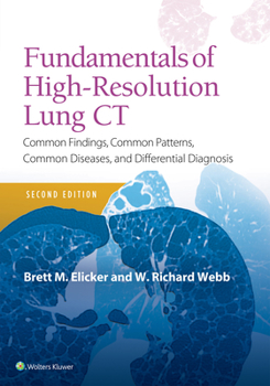 Paperback Fundamentals of High-Resolution Lung CT: Common Findings, Common Patterns, Common Diseases and Differential Diagnosis Book