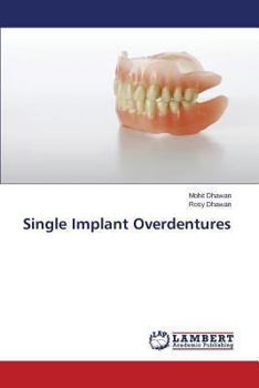 Paperback Single Implant Overdentures Book