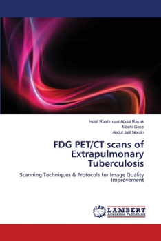 Paperback FDG PET/CT scans of Extrapulmonary Tuberculosis Book