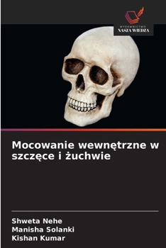 Mocowanie wewnetrzne w szczece i zuchwie (Polish Edition)