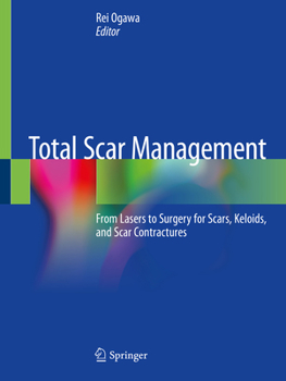 Paperback Total Scar Management: From Lasers to Surgery for Scars, Keloids, and Scar Contractures Book