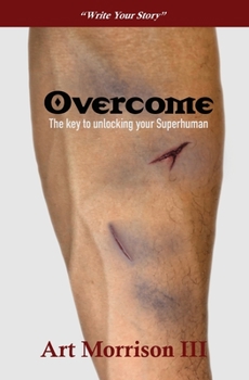 Paperback Overcome: The Key to Unlocking your Superhuman Book