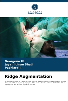 Paperback Ridge Augmentation [German] Book