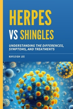 Herpes Versus Shingles: Understanding the Differences, Symptoms, and Treatments: Herpes Book