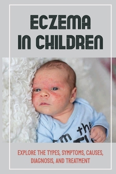 Paperback Eczema In Children: Explore The Types, Symptoms, Causes, Diagnosis, And Treatment: Discoid Eczema Book