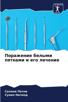 Paperback Поражение белыми пятнам& [Russian] Book