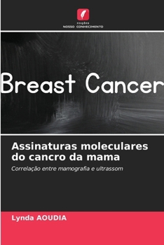 Paperback Assinaturas moleculares do cancro da mama [Portuguese] Book