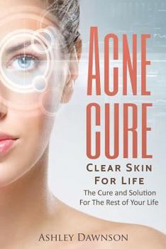 Paperback Acne Cure Clear Skin For Life Book