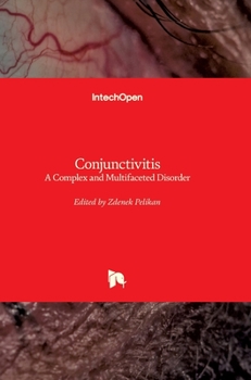 Hardcover Conjunctivitis: A Complex and Multifaceted Disorder Book