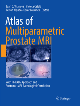 Paperback Atlas of Multiparametric Prostate MRI: With Pi-Rads Approach and Anatomic-Mri-Pathological Correlation Book