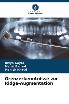 Paperback Grenzerkenntnisse zur Ridge-Augmentation [German] Book