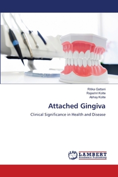 Attached Gingiva