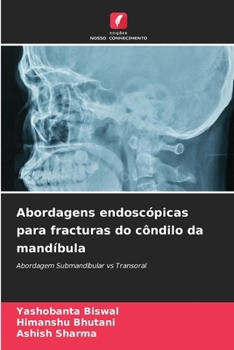 Paperback Abordagens endoscópicas para fracturas do côndilo da mandíbula [Portuguese] Book