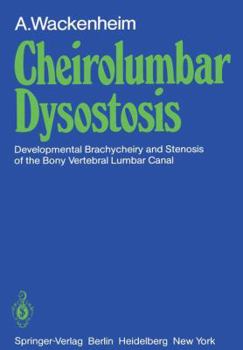 Paperback Cheirolumbar Dysostosis: Developmental Brachycheiry and Stenosis of the Bony Vertebral Lumbar Canal Book