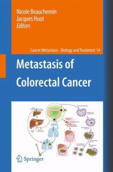 Paperback Metastasis of Colorectal Cancer Book