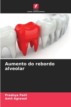 Paperback Aumento do rebordo alveolar [Portuguese] Book