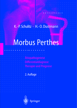 Hardcover Morbus Perthes: A"tiopathogenese, Differentialdiagnose, Therapie Und Prognose Book
