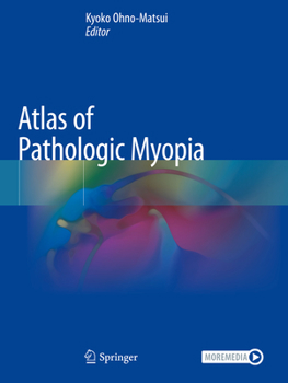 Paperback Atlas of Pathologic Myopia Book