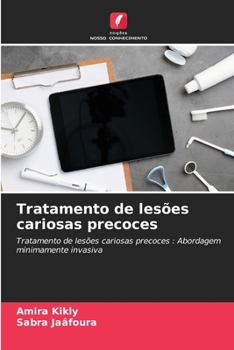 Paperback Tratamento de lesões cariosas precoces [Portuguese] Book