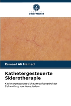 Paperback Kathetergesteuerte Sklerotherapie [German] Book