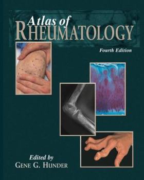 Hardcover Atlas of Rheumatology Book