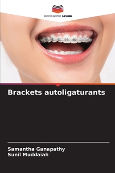 Paperback Brackets autoligaturants [French] Book