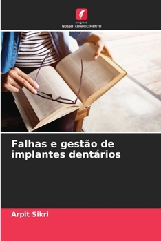 Paperback Falhas e gestão de implantes dentários [Portuguese] Book