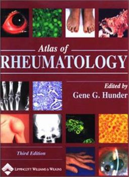 Hardcover Atlas of Rheumatology: Copublished with Current Medicine Book