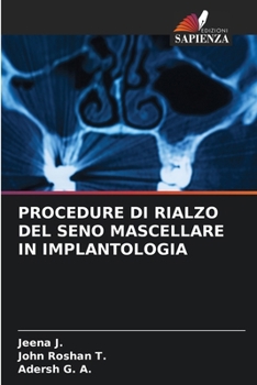 Paperback Procedure Di Rialzo del Seno Mascellare in Implantologia [Italian] Book