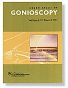 Paperback Color Atlas of Gonioscopy Book