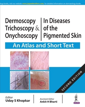 Dermoscopy, Trichoscopy & Onychoscopy In Diseases of the Pigmented Skin An Atlas and Short Text