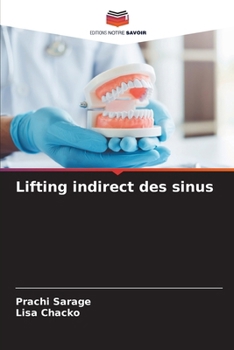 Paperback Lifting indirect des sinus [French] Book