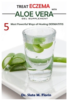 Paperback Treat Eczema With Aloe Vera Gel Supplement: 5 most powerful ways of Healing Dermatitis Book