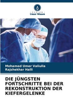 Paperback Die Jüngsten Fortschritte Bei Der Rekonstruktion Der Kiefergelenke [German] Book