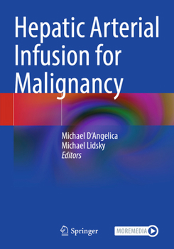 Paperback Hepatic Arterial Infusion for Malignancy Book